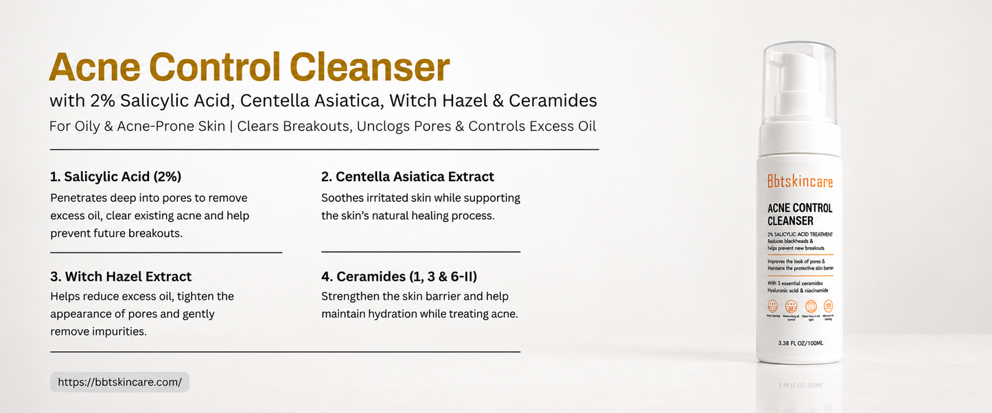 ACNE CONTROL CLEANSER (For oily and acne prone skin)
